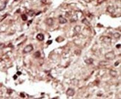 PHKG1 Antibody in Immunohistochemistry (IHC)