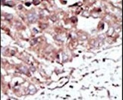 PHKG2 Antibody in Immunohistochemistry (IHC)
