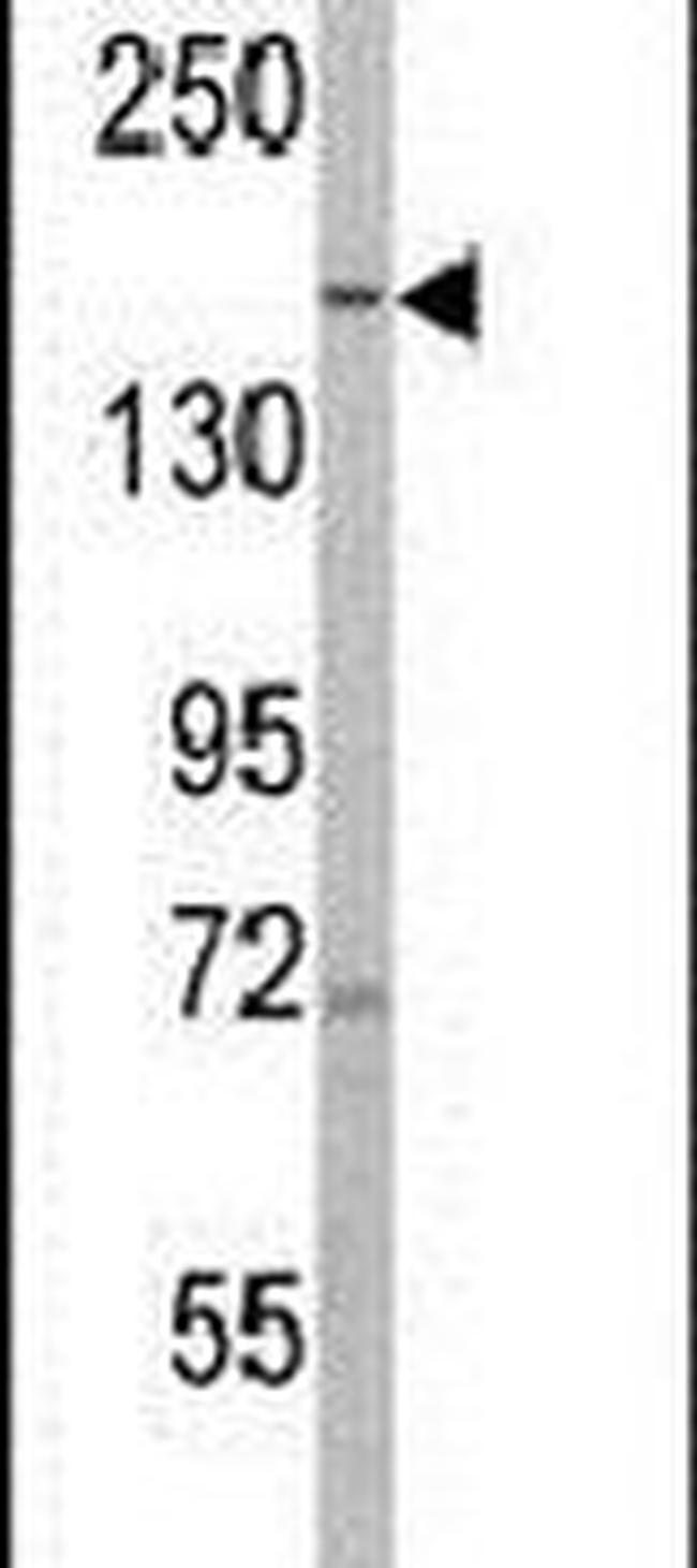 PHLPP1 Antibody in Western Blot (WB)