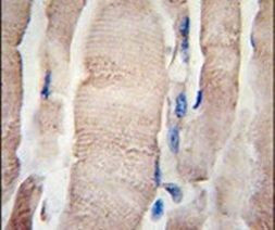 PHPT1 Antibody in Immunohistochemistry (IHC)