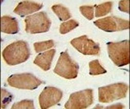 PHYH Antibody in Immunohistochemistry (IHC)