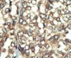 PI4K2B Antibody in Immunohistochemistry (IHC)
