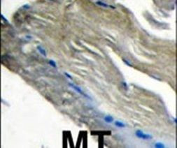PIK3CG Antibody in Immunohistochemistry (IHC)