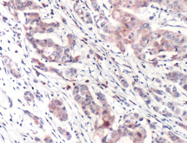 PI3K p85 alpha Antibody in Immunohistochemistry (IHC)