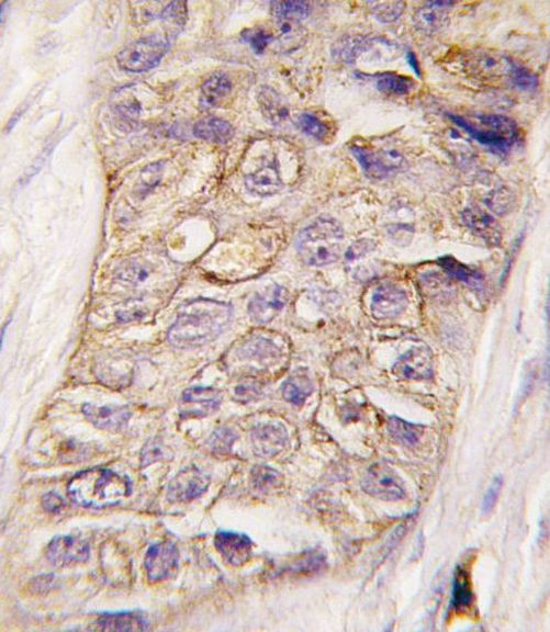 PIK3C2B Antibody in Immunohistochemistry (IHC)