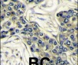 PIK3CA Antibody in Immunohistochemistry (IHC)