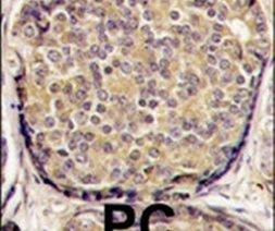 PIK3CB Antibody in Immunohistochemistry (IHC)