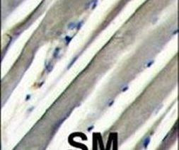 PI3K p85 alpha Antibody in Immunohistochemistry (IHC)