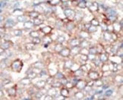 PIK3R4 Antibody in Immunohistochemistry (IHC)
