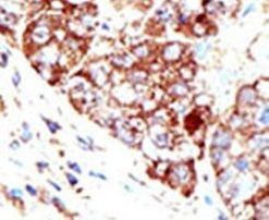 PIAS1 Antibody in Immunohistochemistry (IHC)