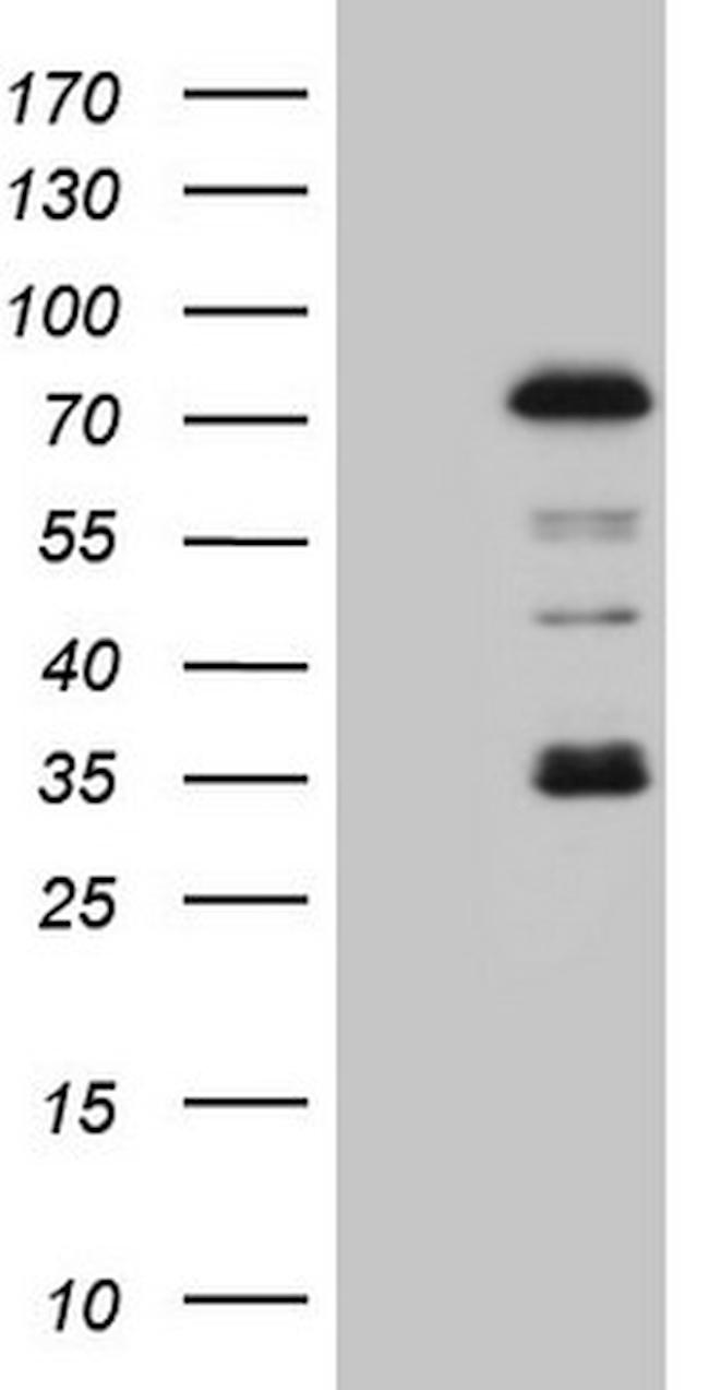 PIAS2 Antibody in Western Blot (WB)