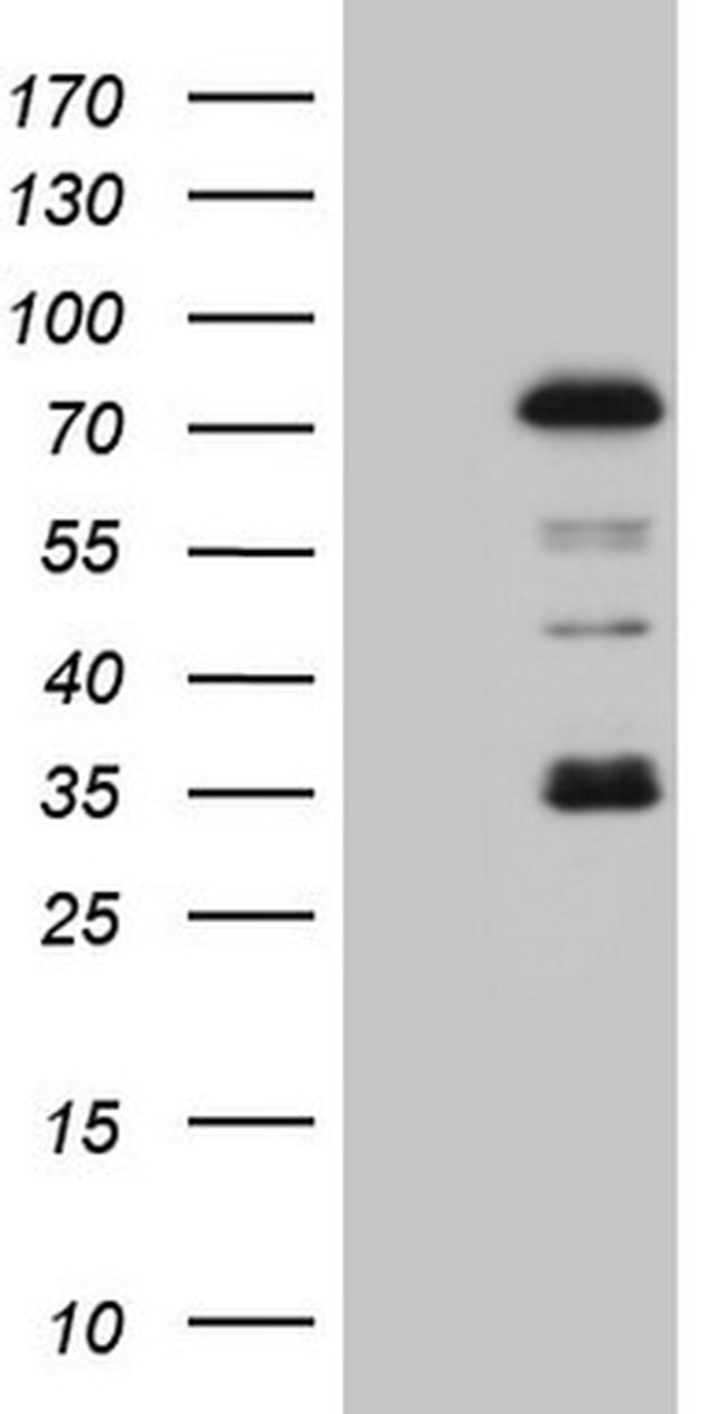 PIAS2 Antibody in Western Blot (WB)