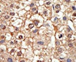 PIASy Antibody in Immunohistochemistry (IHC)