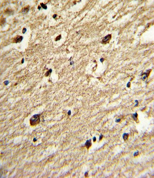 PIASy Antibody in Immunohistochemistry (IHC)