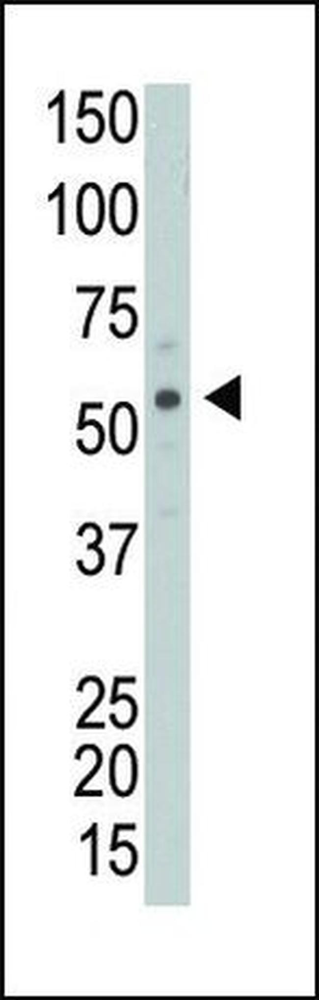 PICK1 Antibody in Western Blot (WB)