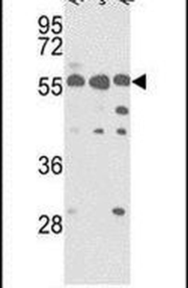 PICK1 Antibody in Western Blot (WB)