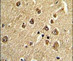 MTA2 Antibody in Immunohistochemistry (IHC)