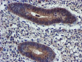 PIH1D2 Antibody in Immunohistochemistry (Paraffin) (IHC (P))