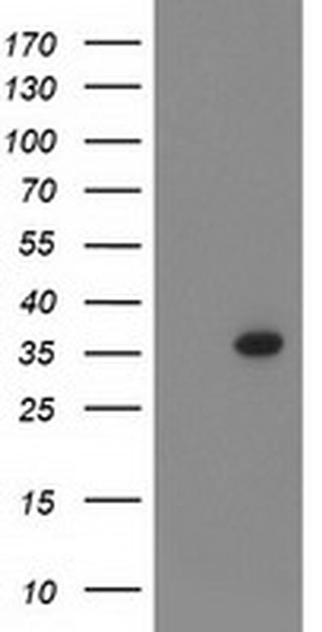 PIH1D2 Antibody in Western Blot (WB)