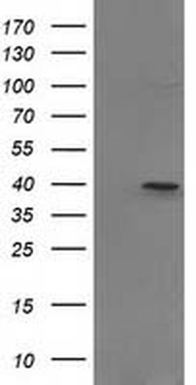 PIH1D2 Antibody in Western Blot (WB)