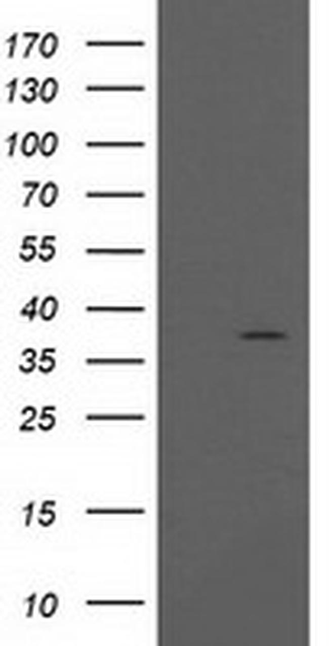 PIH1D2 Antibody in Western Blot (WB)