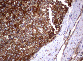 PIK3C2A Antibody in Immunohistochemistry (Paraffin) (IHC (P))