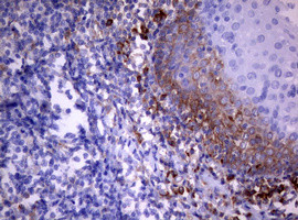 PIK3C2A Antibody in Immunohistochemistry (Paraffin) (IHC (P))