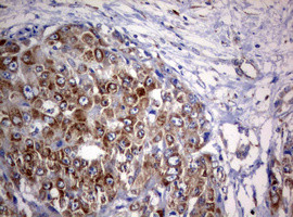 PIK3C2A Antibody in Immunohistochemistry (Paraffin) (IHC (P))