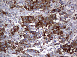 PIK3C2A Antibody in Immunohistochemistry (Paraffin) (IHC (P))