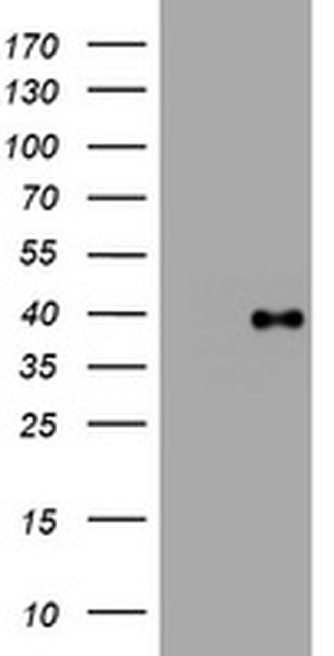PIK3C2A Antibody in Western Blot (WB)