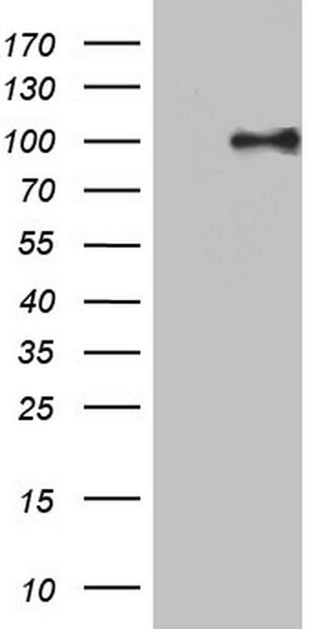 PIK3CD Antibody in Western Blot (WB)