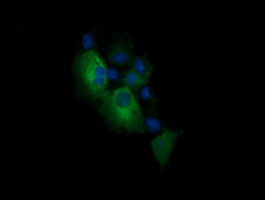 PIK3CG Antibody in Immunocytochemistry (ICC/IF)