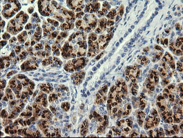 PIK3CG Antibody in Immunohistochemistry (Paraffin) (IHC (P))