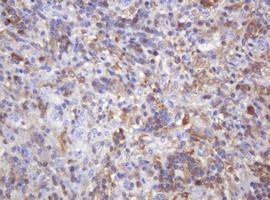 PIK3CG Antibody in Immunohistochemistry (Paraffin) (IHC (P))