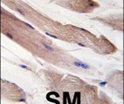 PI3K p85 alpha Antibody in Immunohistochemistry (IHC)