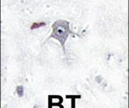 PIK3R2 Antibody in Immunohistochemistry (IHC)