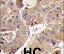 PI3K p55 gamma Antibody in Immunohistochemistry (IHC)