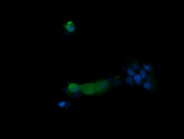 PIK3R5 Antibody in Immunocytochemistry (ICC/IF)