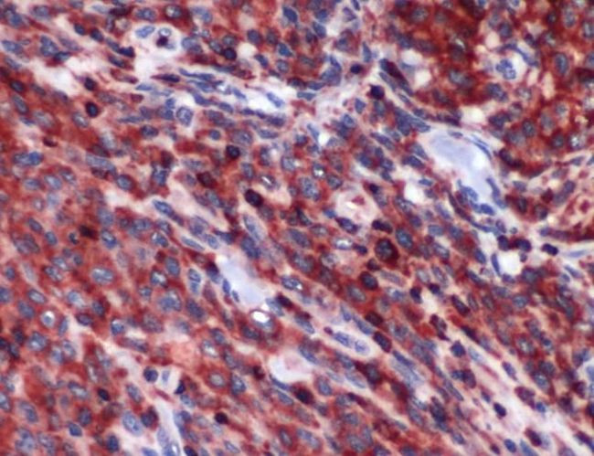 PIM2 Antibody in Immunohistochemistry (IHC)