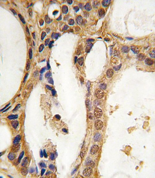 PIM1 Antibody in Immunohistochemistry (IHC)