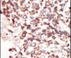 PIM2 Antibody in Immunohistochemistry (IHC)