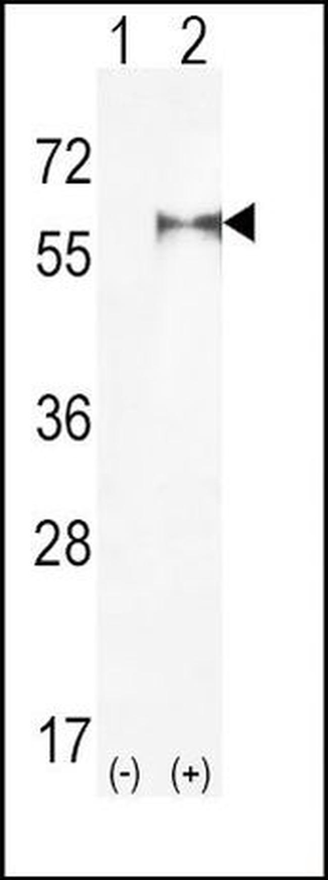 PIP5K1A Antibody in Western Blot (WB)