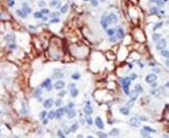 PIP4K2B Antibody in Immunohistochemistry (IHC)