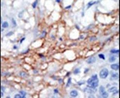 PIP5K1C Antibody in Immunohistochemistry (IHC)