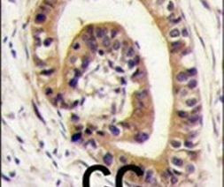 PIST Antibody in Immunohistochemistry (IHC)