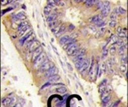 PIST Antibody in Immunohistochemistry (IHC)
