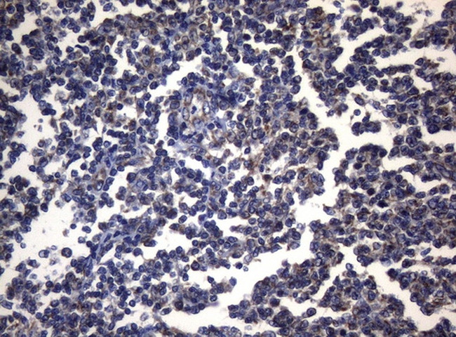 PITPNB Antibody in Immunohistochemistry (Paraffin) (IHC (P))