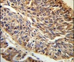 PITX1 Antibody in Immunohistochemistry (IHC)