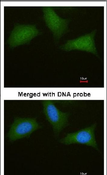 PRKAR1A Antibody in Immunocytochemistry (ICC/IF)