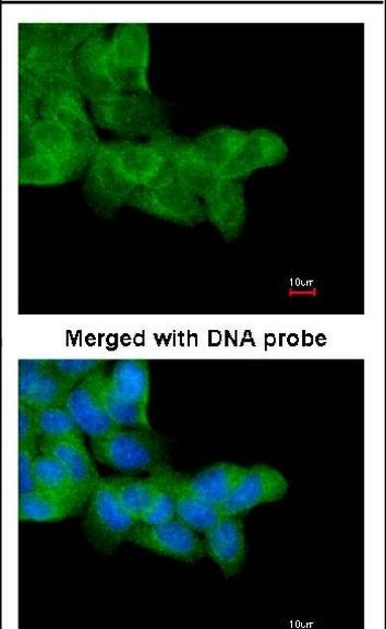 PRKAR1A Antibody in Immunocytochemistry (ICC/IF)
